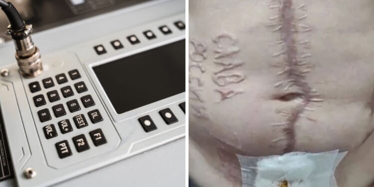 Russia's horror 'call to Putin' torture method explained – and it will make you wince | World | News