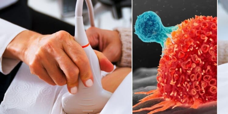 The foods rocketing your risk of the disease by up to 58%