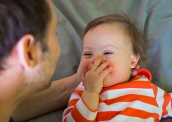 We should see possibility, not limitation, in children with Down syndrome