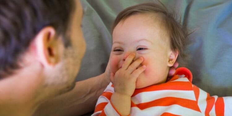 We should see possibility, not limitation, in children with Down syndrome