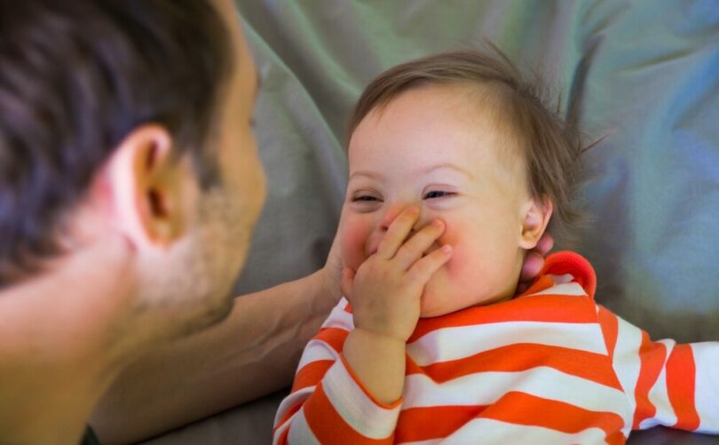 We should see possibility, not limitation, in children with Down syndrome