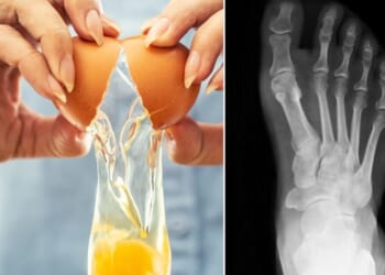 Eating eggs may halt disease thanks to bone-boosting compound, scientists discover