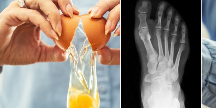 Eating eggs may halt disease thanks to bone-boosting compound, scientists discover