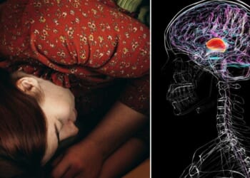 Mouth-taping sleep hack sparks health fears as specialists issue warning of severe risks