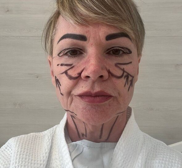 Angela Paterson just before surgery