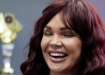 'Lithuania facelift left me with lopsided mouth and hearing loss'