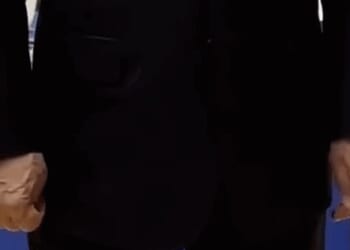 Putin health fears as swollen veins look 'extremely painful' | World | News