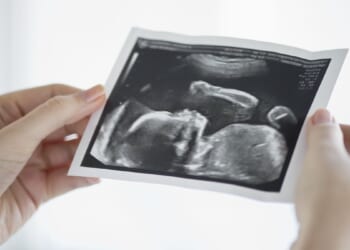 Scotland May Soon Allow Abortions Up To Birth For ‘Social Reasons’