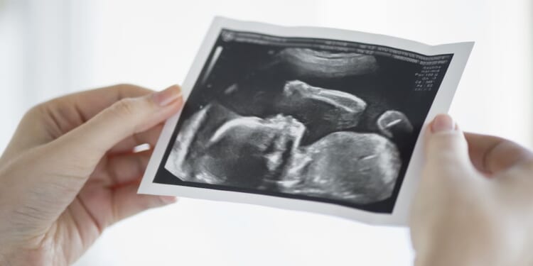 Scotland May Soon Allow Abortions Up To Birth For ‘Social Reasons’