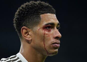 England star left with blood streaming down his face as three red cards shown in disastrous defeat