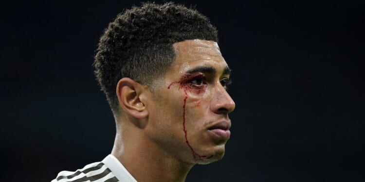 England star left with blood streaming down his face as three red cards shown in disastrous defeat
