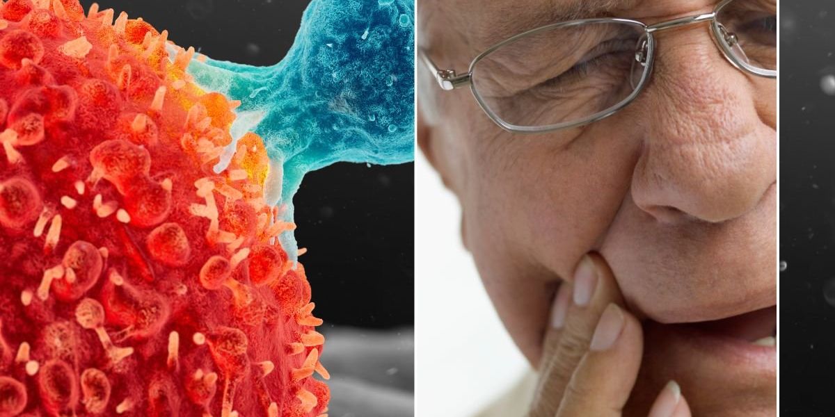 'One of the most important' signs of mouth cancer named by doctor as festive drinking warning issued