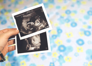 New Puerto Rico law recognizes unborn children as people