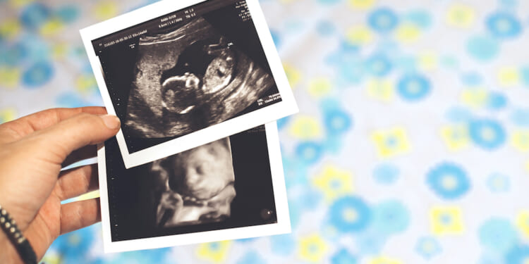 New Puerto Rico law recognizes unborn children as people