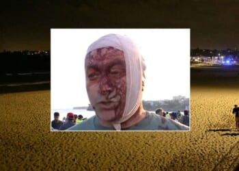 Bondi Beach shooting: Jewish leader injured in Bondi terror attack after surviving October 7: 'It was a bloodbath'!