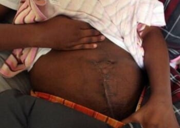 Pregnant woman sliced open in box cutter attack as stranger tries to steal baby | World | News