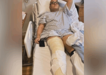 Tui staff member left customer in need of surgery after being 'physically assaulted' on holiday