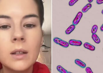 Woman says unusual smell after antibiotics was warning sign of life-threatening infection
