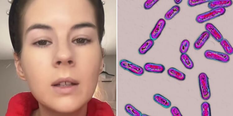 Woman says unusual smell after antibiotics was warning sign of life-threatening infection
