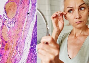 Scientists say going grey could be your body defending itself against cancer