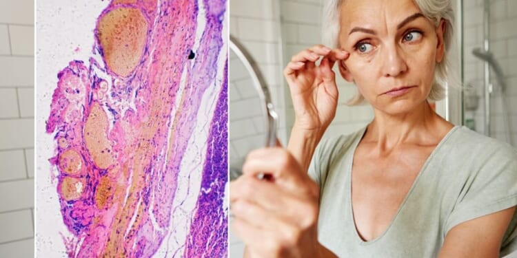 Scientists say going grey could be your body defending itself against cancer