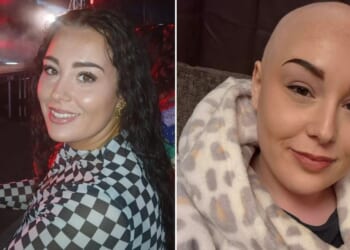 Cancer: Woman diagnosed at 25 after three symptoms raised alarm