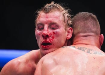 British UFC 324 star rushed to hospital after brutal defeat that left blood pouring from eye wound
