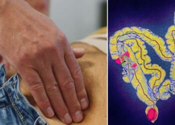'Major step forward' in detection as improved test could save thousands of lives