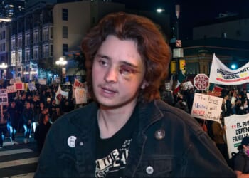 California man blinded by federal officer during ICE protest