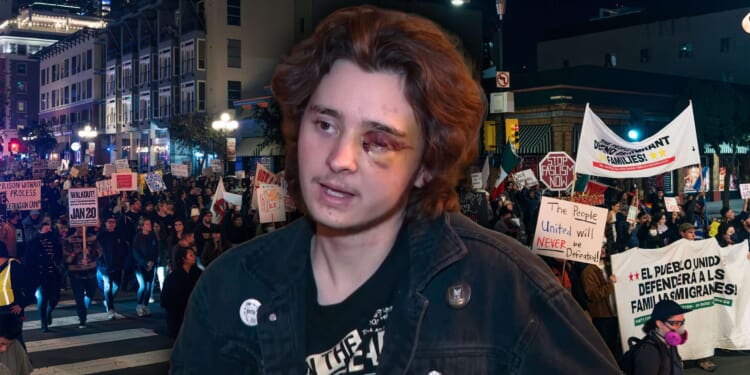 California man blinded by federal officer during ICE protest