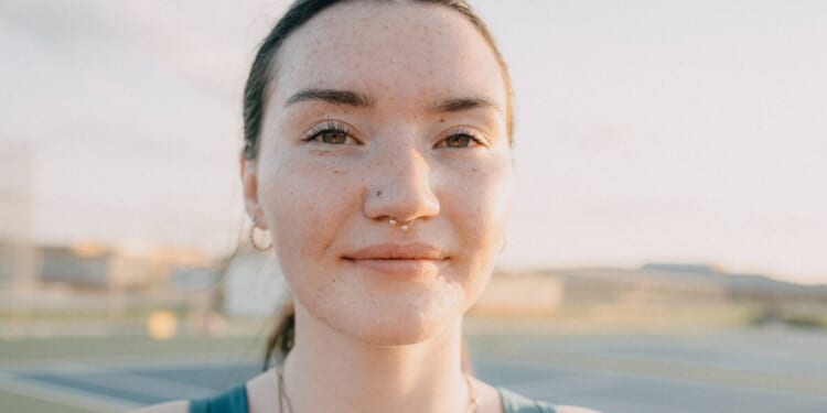 Doctor on why pale skin is warning sign you need 1 thing