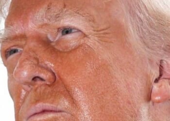 Trump health fears resurface after 'radioactive' facial bruise spotted | US | News