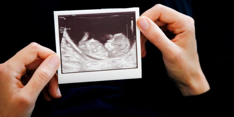 Being Pro-life Can Turn The Cruelest Circumstances Into Hope And Love